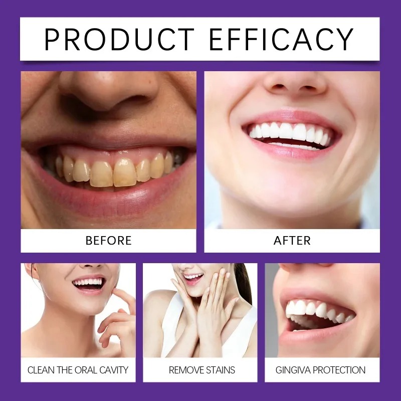 Mor Diş Restorasyon Mineral To - Teeth Whitening Near Me incelemesi ve fiyatı